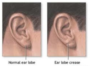 ear-lobe